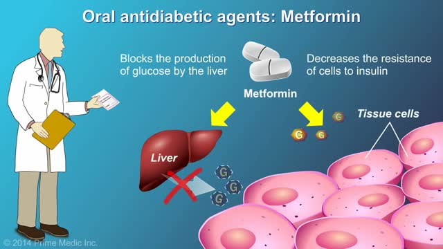 Treatment and Management of Type 2 Diabetes