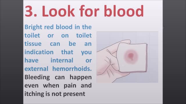 ⁣Treat HEMORRHOIDS