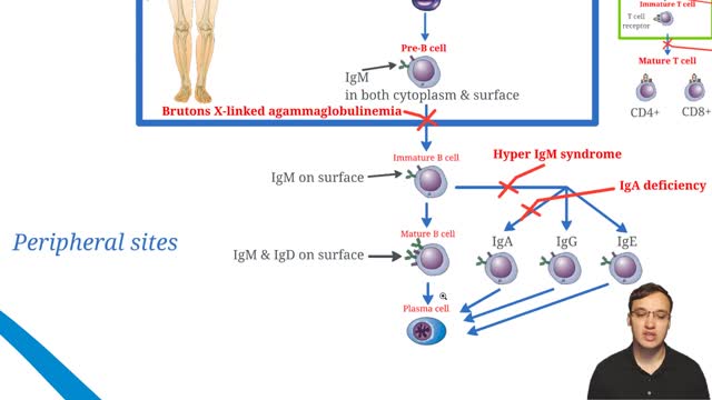 Bruton's X linked agammaglobulinemia