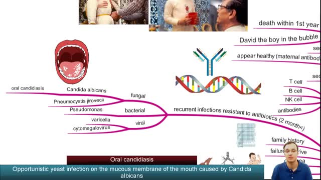 Severe combined immunodeficiency