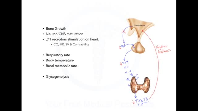 Hyperthyroidism