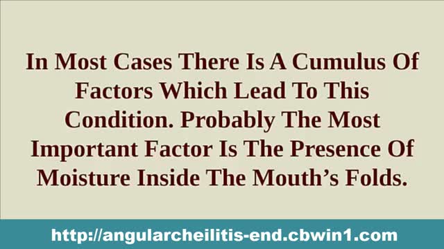 Corner Of Mouth Cracked, Angular Cheilitis, Home Remedies For Angular Cheilitis, Angular Cheilitis