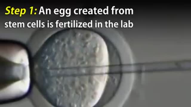 Artificial womb