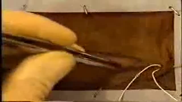 Continuous Connell Pattern Suture