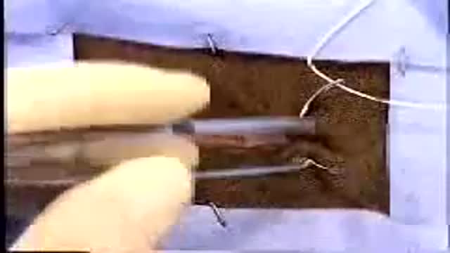 Lembert Pattern Suture