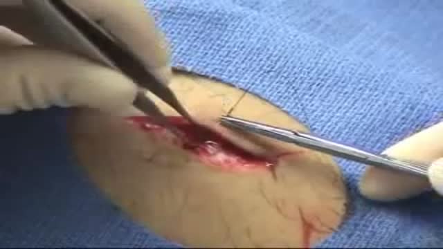 ⁣Wound | Suturing Techniques