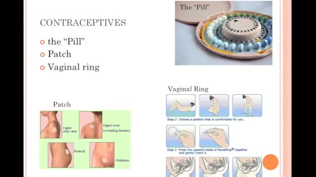 Contraceptive Methods