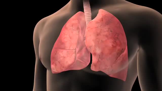 Lung Cancer