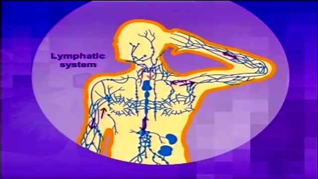 ⁣Lymphoma