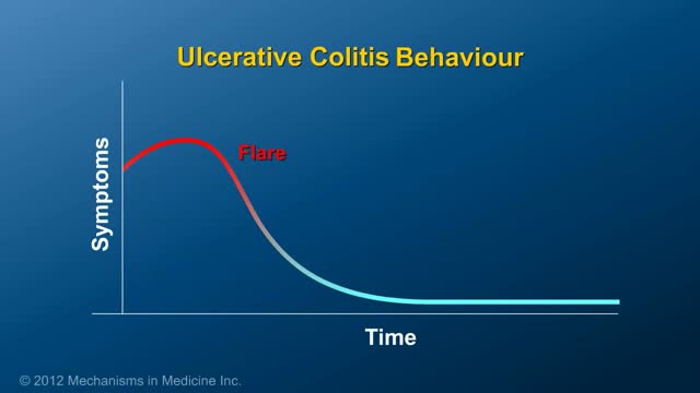 Ulcerative Colitis