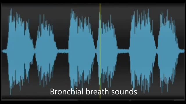 ⁣Physiological & pathological breath sounds