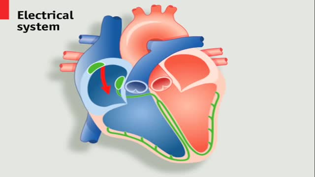 Heart Pacemaker