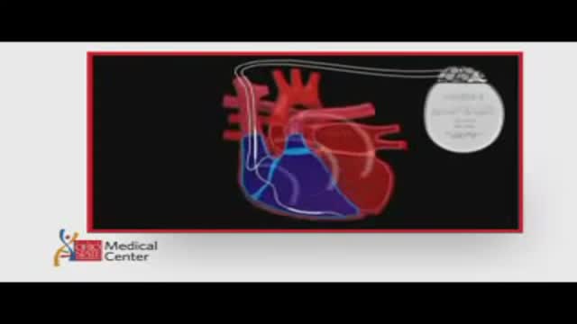 Pacemakers & Implantable Defibrillators