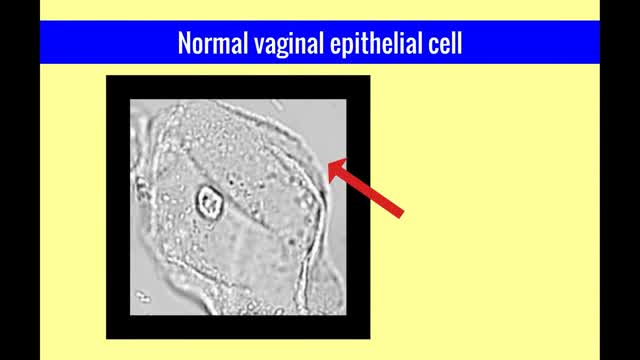 Vulvar and Vaginal Disease