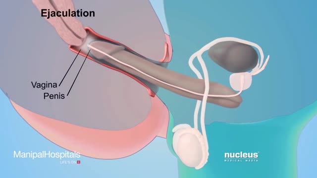 How To Use Male Condom Correctly