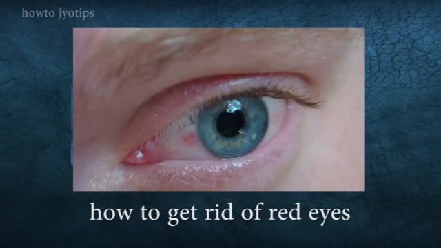 Red Eyes