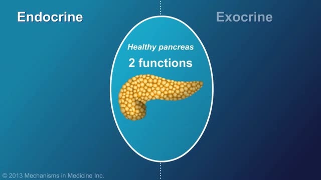 ⁣Chronic Pancreatitis