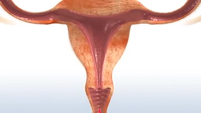 Why do women bleed during the menstrual cycle?