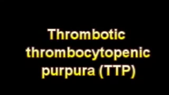 ⁣Thrombotic thrombocytopenic purpura