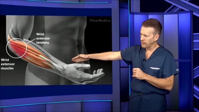 ⁣Tennis Elbow Surgery