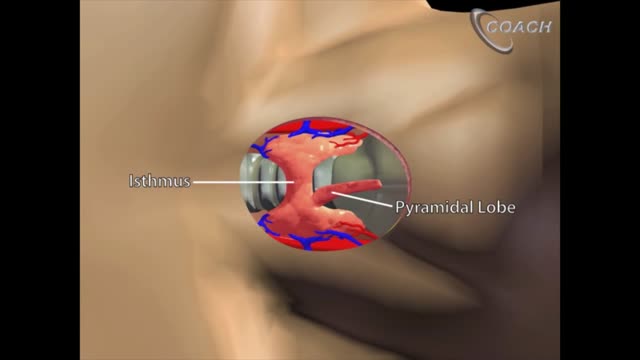 Minimally Invasive Total Thyroidectomy