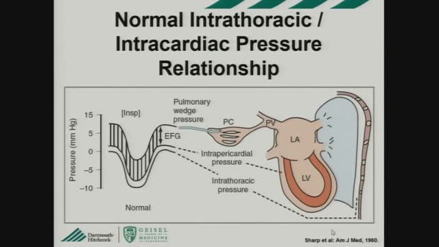 ⁣Constrictive pericarditis versus restrictive cardiomyopathy