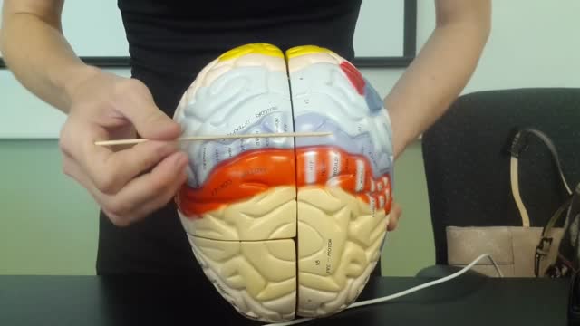 The Brain and Cranial Nerves