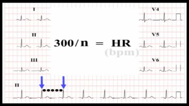 ⁣ECG Interpretation