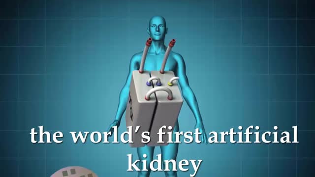 Artificial Kidney Transplant