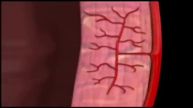 ⁣Myocardial Blood Flow