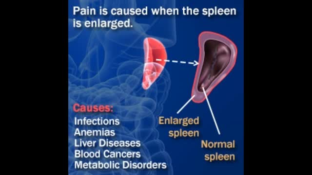 ⁣Spleen Pain Causes