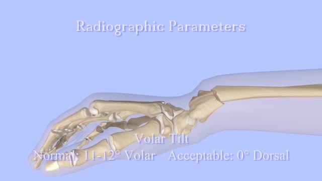 ⁣Closed Reduction of a Distal Radius Fracture