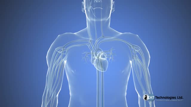 Cardiac catheterizatio