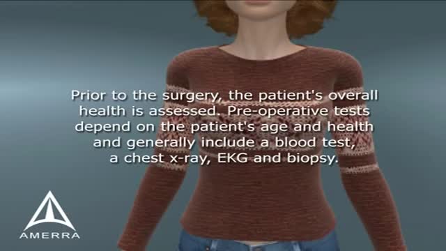 Modified Radical Mastectomy