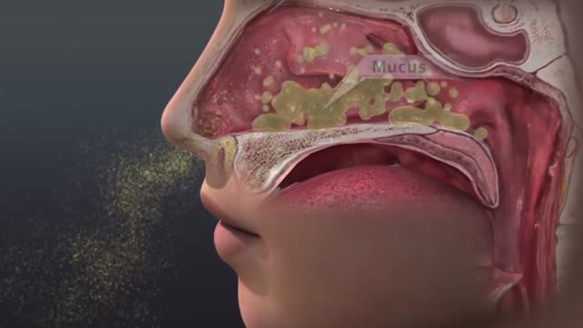 ⁣Can saline irrigation help nasal allergies?