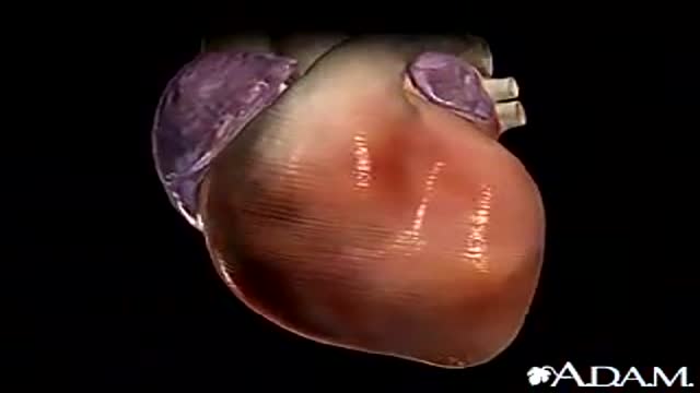 Cardiac Arrhythmia