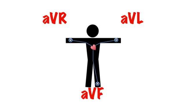 Cardiac Axis in 5 min