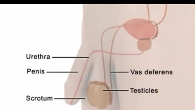 ⁣Vasectomy