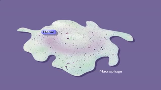 ⁣Hemoglobin Breakdown