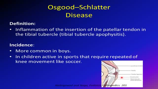 Osgood Schlatter disease