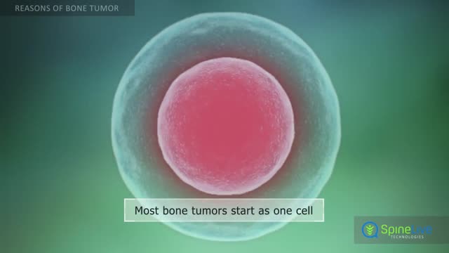 ⁣Bone Tumor. Reasons