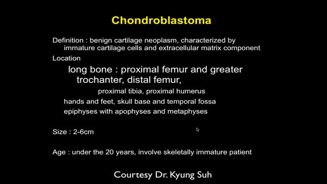 MRI of Bone Tumor