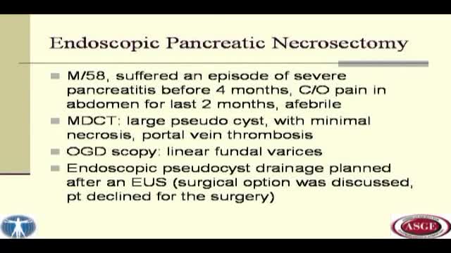 Endoscopic Transgastric Pancreatic Necrosectomy