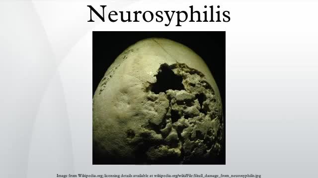 Neurosyphilis