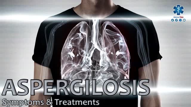 ⁣ASPERGILLOSIS