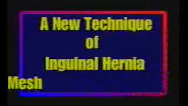 ⁣New tension free open inguinal hernia repair without mesh based on the physiological principle