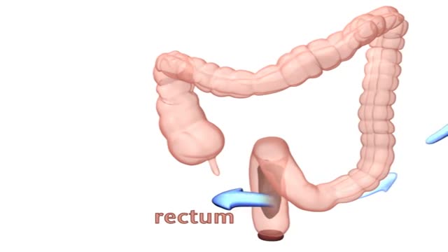 ⁣Constipation and Encopresis