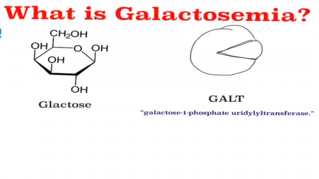 Galactosemia