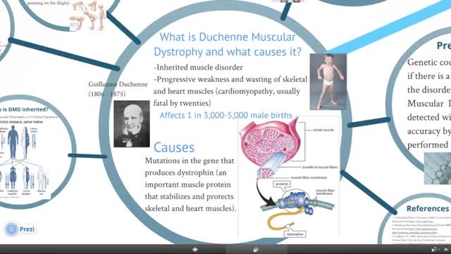 Duchenne and Becker Muscular Dystrophies