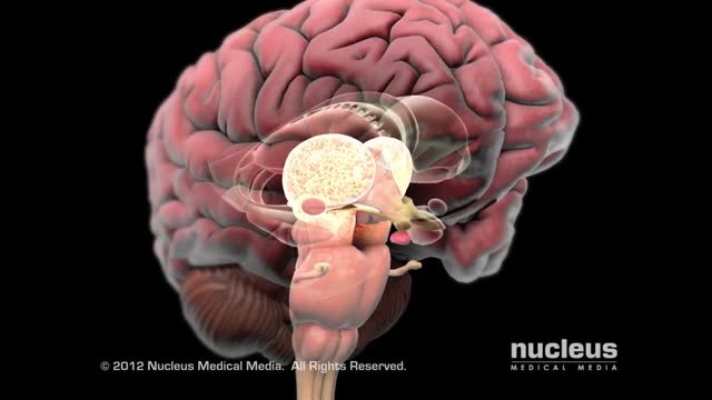 Complex Regional Pain Syndrome